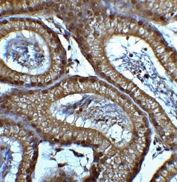 a00223 smarca4 primary antibodies ihc testing 4