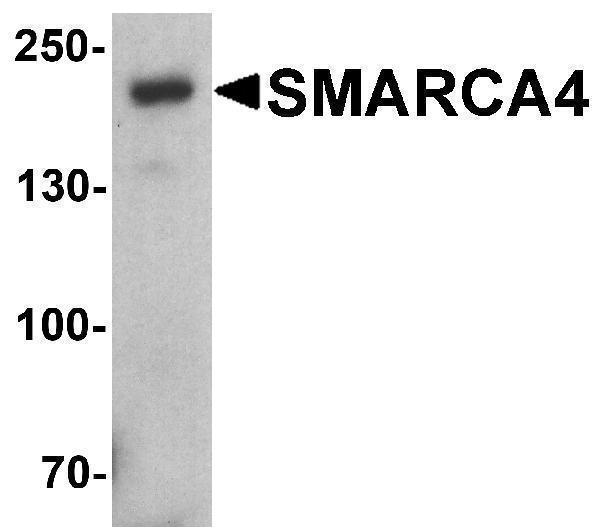Western blot analysis of SMARCA4 in SK-N-SH cell lysate with SMARCA4 antibody at 1 μg/ml