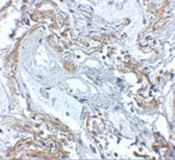 Immunohistochemistry of TNFAIP3 in human lung tissue with TNFAIP3 antibody at 5 μg/mL