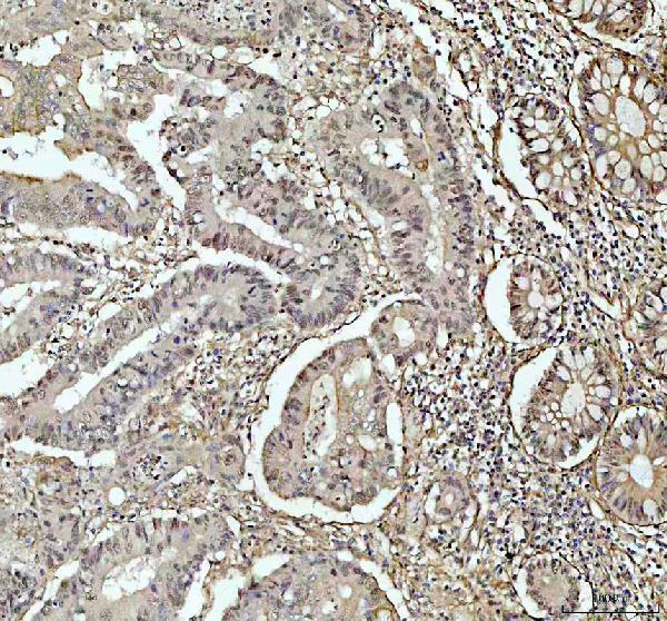 a00225 4 ahr primary antibodies ihc testing 2_2_1