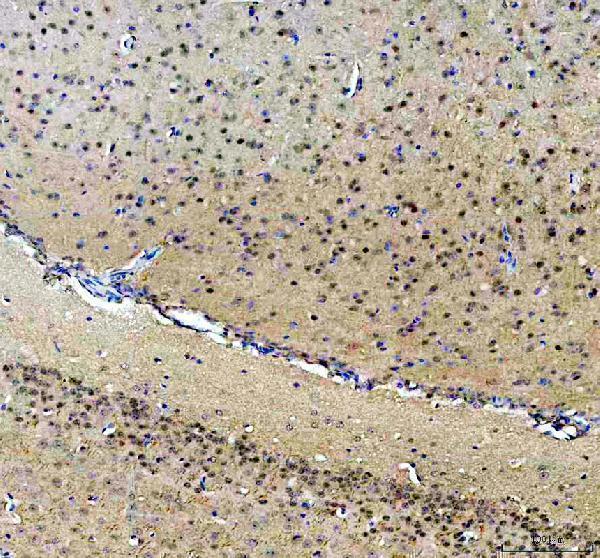 a00225 4 ahr primary antibodies ihc testing 3_2_1