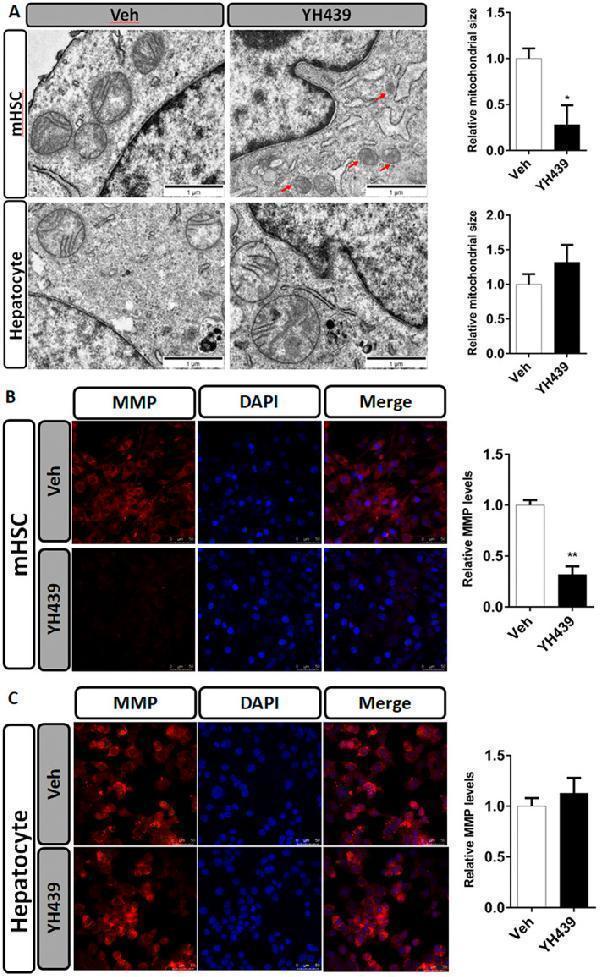 AHR increases the sensitivity of HSC to ferroptosis