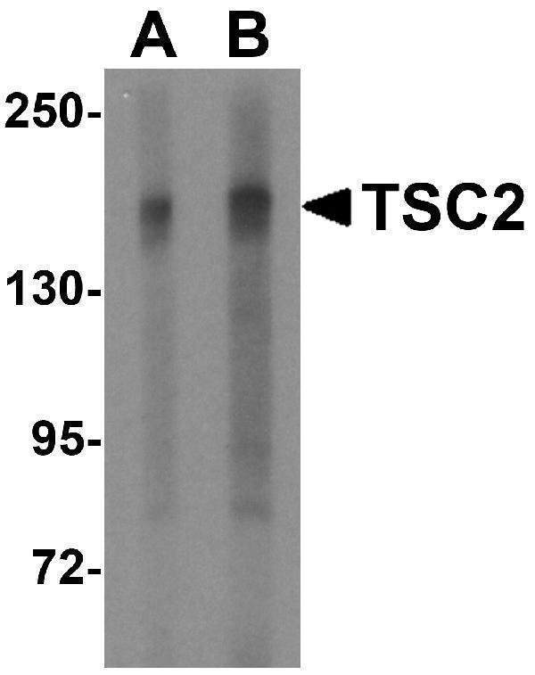 a00229 tsc2 primary antibodies wb testing 1