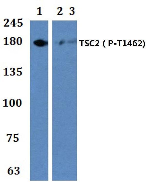 a00229t1462 1 tsc2 primary antiboties wb testing 1_1