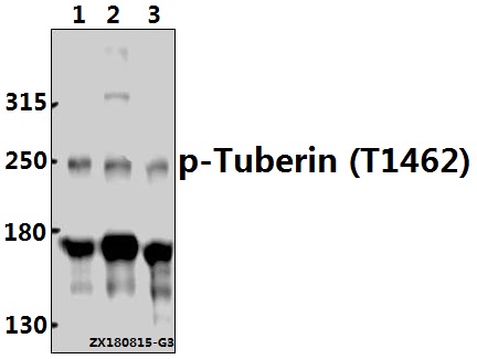 a00229t1462 tsc2 primary antiboties wb testing 1