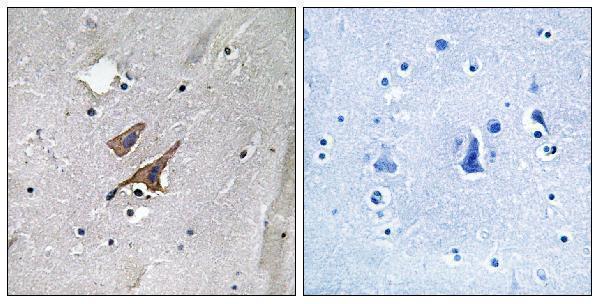 a00229y1571 tsc2 primary antibodies ihc testing 3