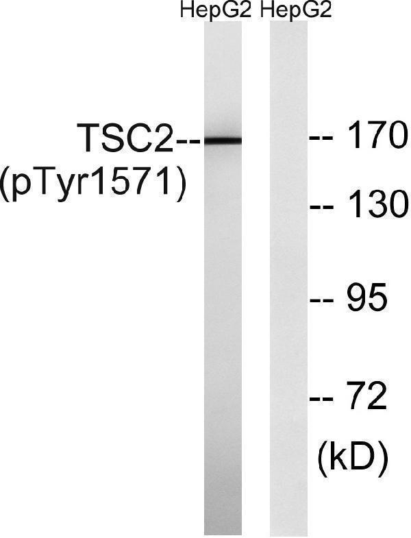 a00229y1571 tsc2 primary antibodies wb testing 2