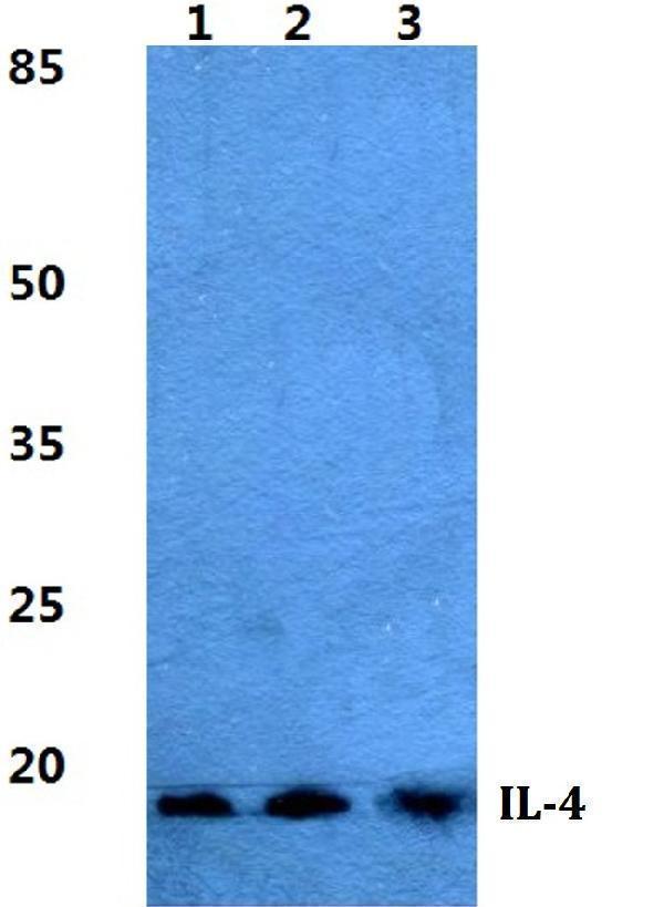 Western blot (WB) analysis of IL-4 polyclonal antibody at 1:500 dilution
Lane1:MCF-7 cell lysate
Lane2:sp2/0 cell lysate
Lane3:PC12 cell lysate