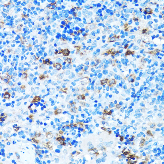 Immunohistochemistry of paraffin-embedded rat spleen using FGFR2 antibody  at dilution of 1:100 