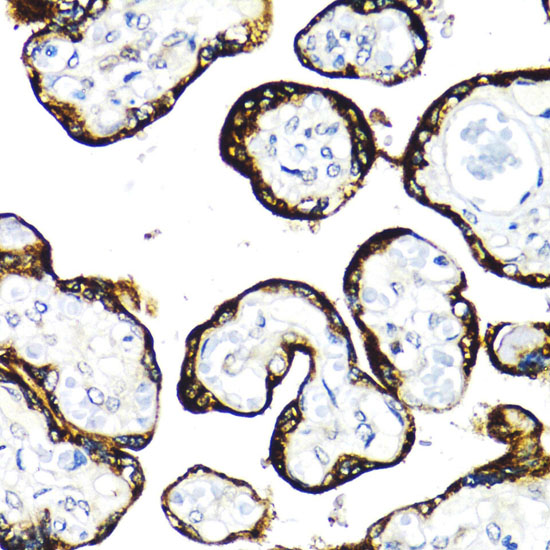 Immunohistochemistry of paraffin-embedded human placenta using FGFR2 antibody  at dilution of 1:100 