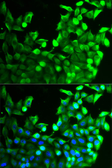 Immunohistochemistry of paraffin-embedded mouse heart using FGFR2 antibody  at dilution of 1:100 