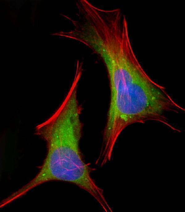 a00231 anti fgfr2 antibody n term if testing 1