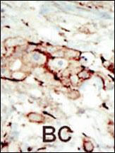 a00231 anti fgfr2 antibody n term ihc p testing 5