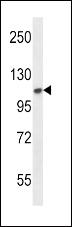 a00231 anti fgfr2 antibody n term wb testing 3
