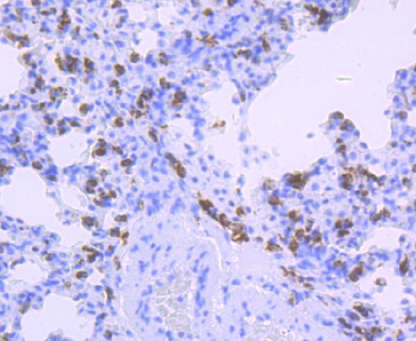 a00232 1 hla dqa1 primary antiboties ihc testing 2