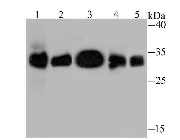 a00232 1 hla dqa1 primary antiboties wb testing 1