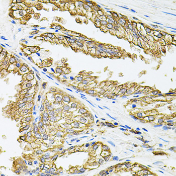 Immunohistochemistry of paraffin-embedded human prostate using HLA-DQA1 antibody  at dilution of 1:100 