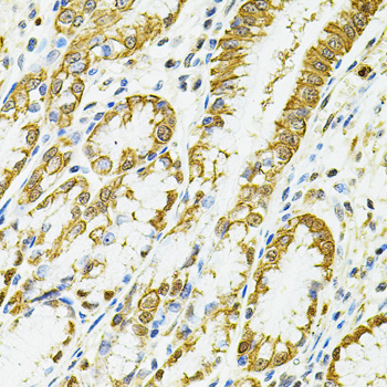 Immunohistochemistry of paraffin-embedded human esophagus using HLA-DQA1 antibody  at dilution of 1:100 
