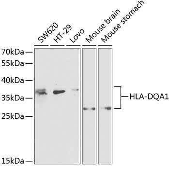 Western blot analysis of extracts of various cell lines, using HLA-DQA1 antibody  at 1:1000 dilution