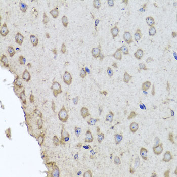 Immunofluorescence analysis of Rat placenta using HBA2 antibody  at dilution of 1:100 