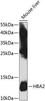 Western blot analysis of extracts of mouse liver, using HBA2 antibody  at 1:1000 dilution