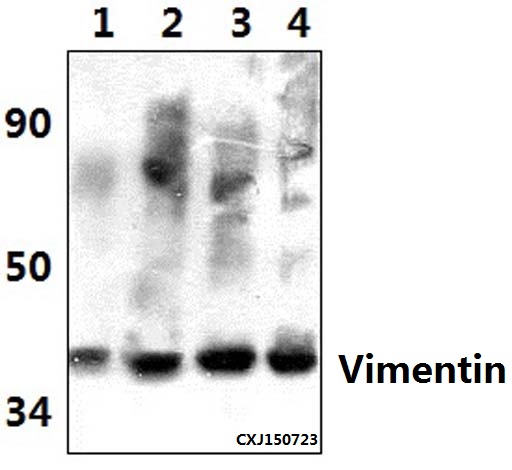 a00235s55 vim primary antiboties wb testing 1