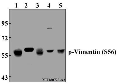 Western blot (WB) analysis of p-Vimentin (S56) pAb at 1:500 dilution
Lane1:MCF-7 whole cell lysate(40µg)
Lane2:A375 whole cell lysate(40µg)
Lane3:C6 whole cell lysate(40µg)
Lane4:The testis tissue lysate of Mouse(40µg)
Lane5:Hela whole cell lysate(40µg)