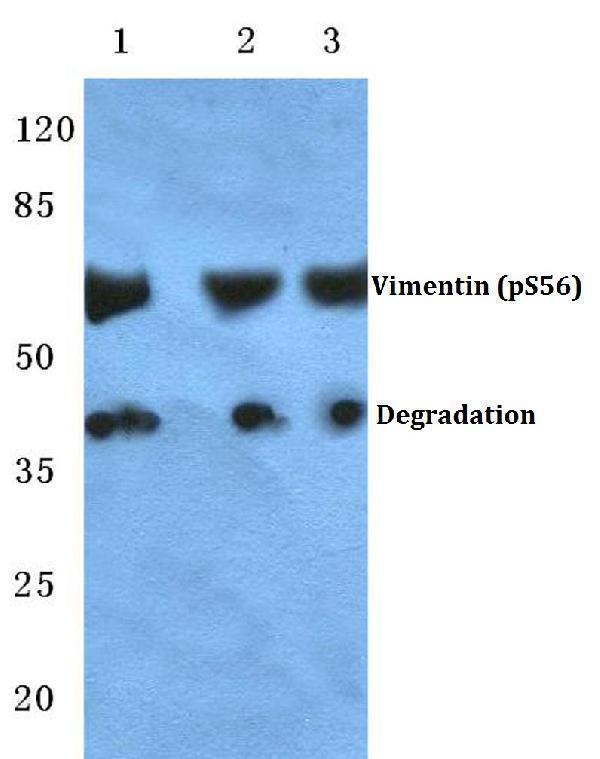 Western blot (WB) analysis of p-Vimentin (S56) polyclonal antibody at 1:500 dilution
Lane1:MCF-7 cell lysate treated with UV(24h)
Lane2:NIH-3T3 cell lysate treated with UV(24h)
Lane3:H9C2 cell lysate treated with UV(24h)