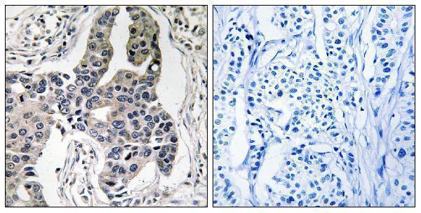 a00235s83 1 vim primary antibodies ihc testing 1