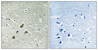 a00235s83 1 vim primary antibodies ihc testing 4