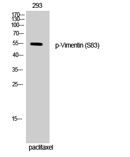 a00235s83 1 vim primary antibodies wb testing 2