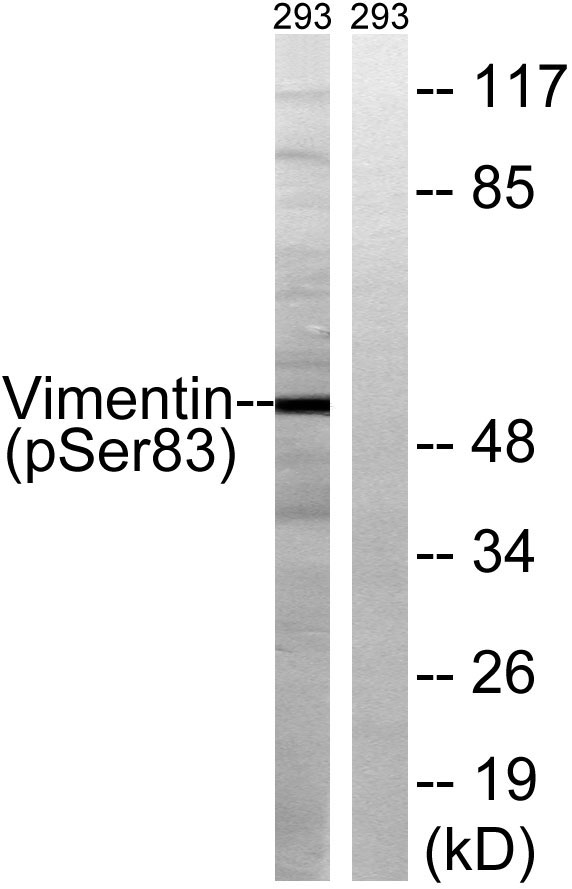 a00235s83 1 vim primary antibodies wb testing 3