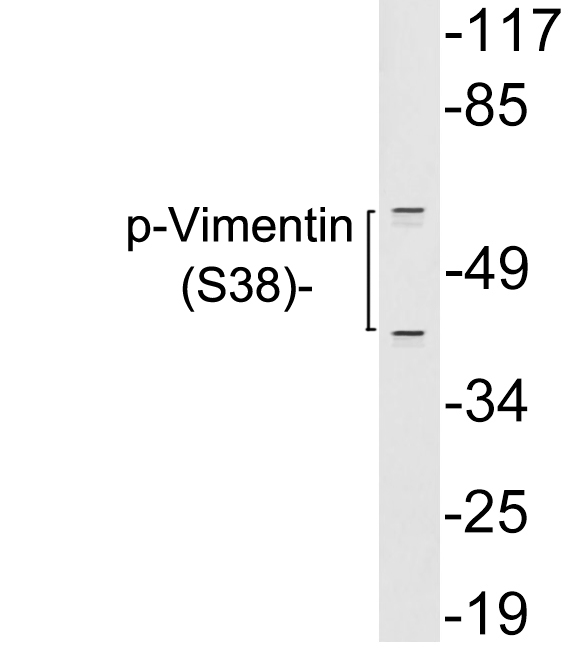 a00235y38 vim primary antibodies wb testing 3