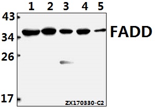 Western blot (WB) analysis of FADD (N188) polyclonal antibody at 1:500 dilution
Lane1:A549 whole cell lysate(40ug)
Lane2:HCT116 whole cell lysate(40ug)
Lane3:Panc1 whole cell lysate(40ug)
Lane4:C6 whole cell lysate(40ug)
Lane5:MEF whole cell lysate(40ug)