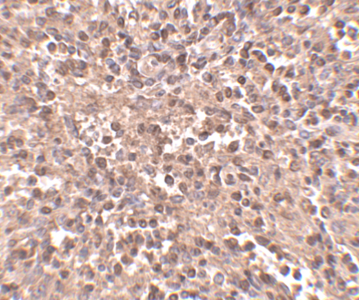 Immunohistochemistry of ATG5 in human spleen tissue with ATG5 antibody at 2