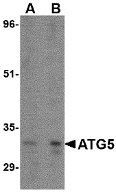 Western blot analysis of ATG5 in rat spleen tissue lysate with ATG5 antibody at (A) 1 and (B) 2 μg/mL