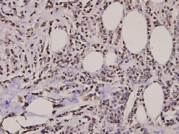 a00241s130 h2afx primary antiboties ihc testing 2