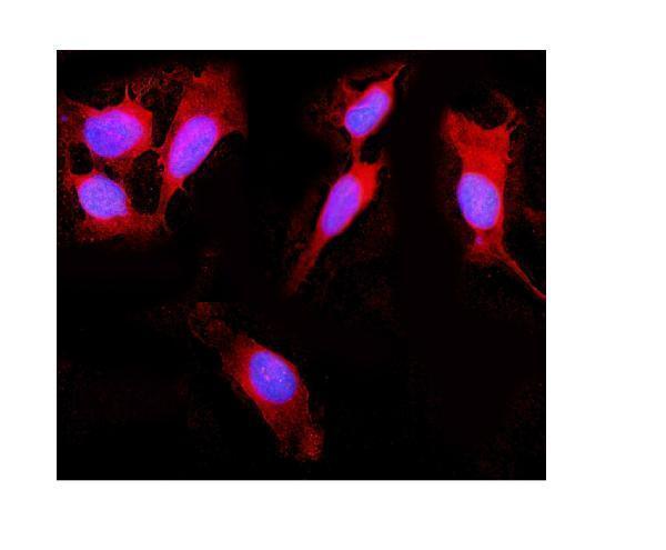 a00244 2 ddx58 primary antibodies if testing 2