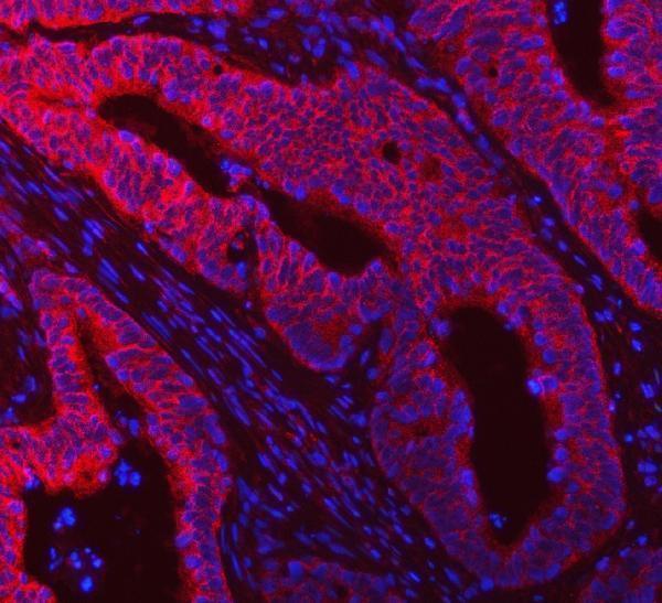 a00244 2 ddx58 primary antibodies if testing 3