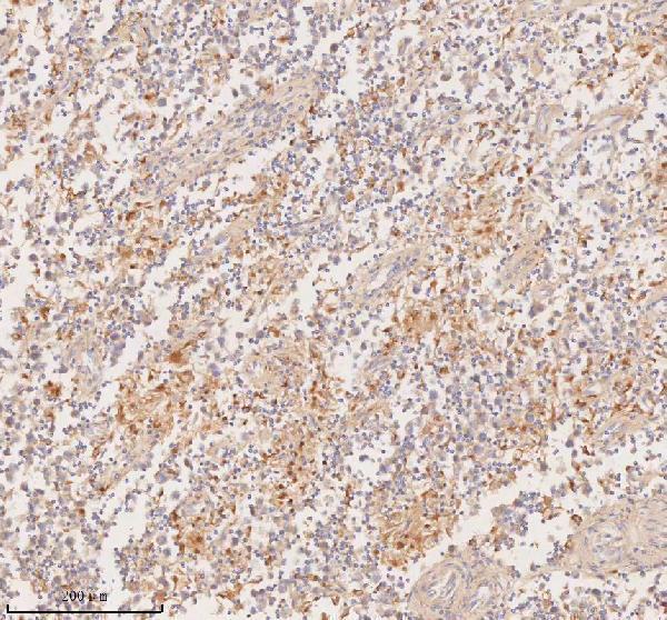 a00244 3 ddx58 primary antibodies ihc testing 10