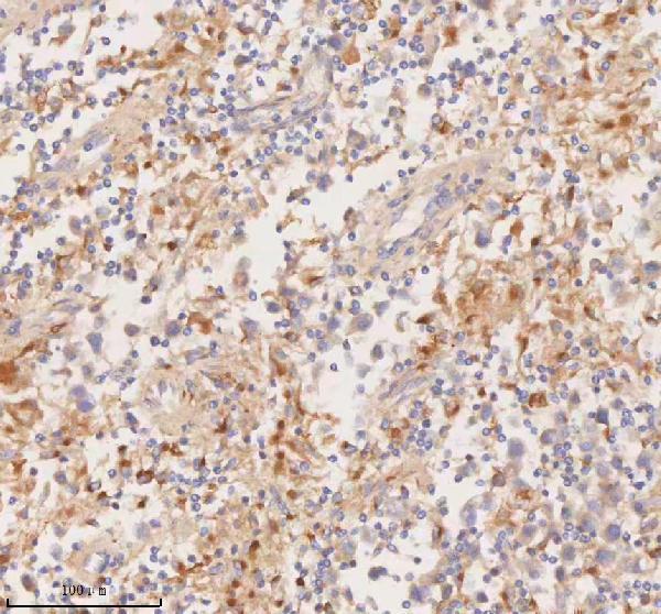 a00244 3 ddx58 primary antibodies ihc testing 11