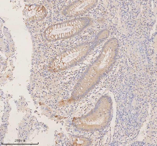 a00244 3 ddx58 primary antibodies ihc testing 2