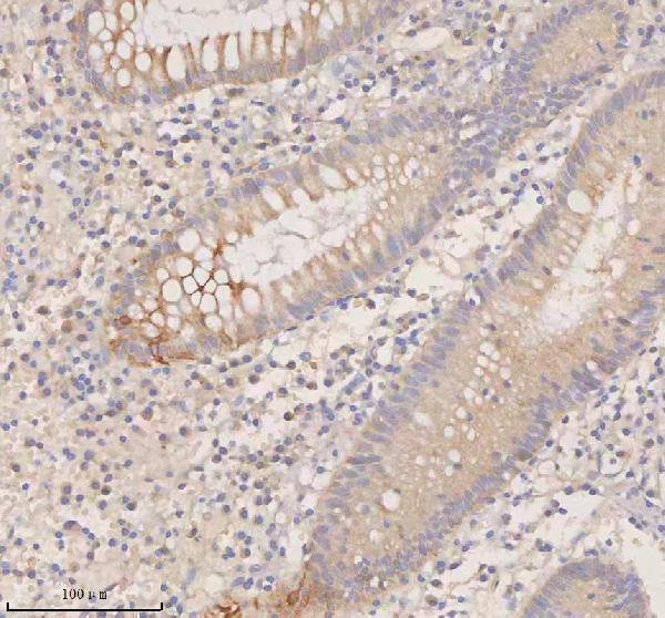 a00244 3 ddx58 primary antibodies ihc testing 3