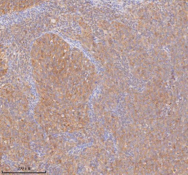 a00244 3 ddx58 primary antibodies ihc testing 4