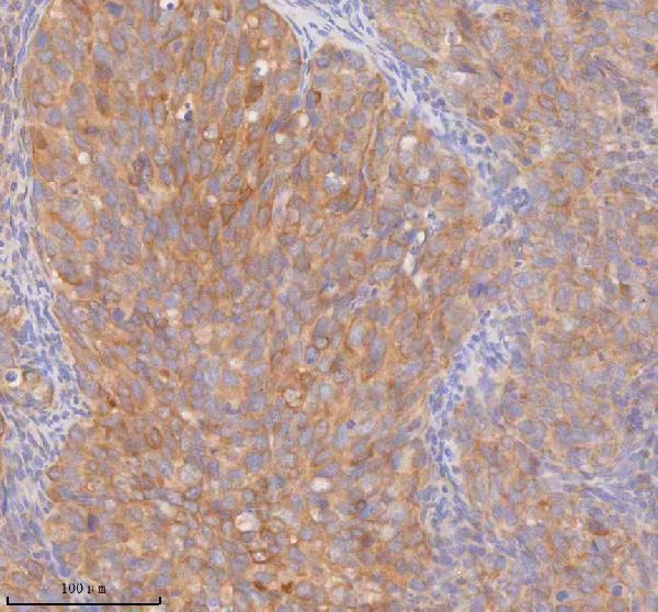 a00244 3 ddx58 primary antibodies ihc testing 5