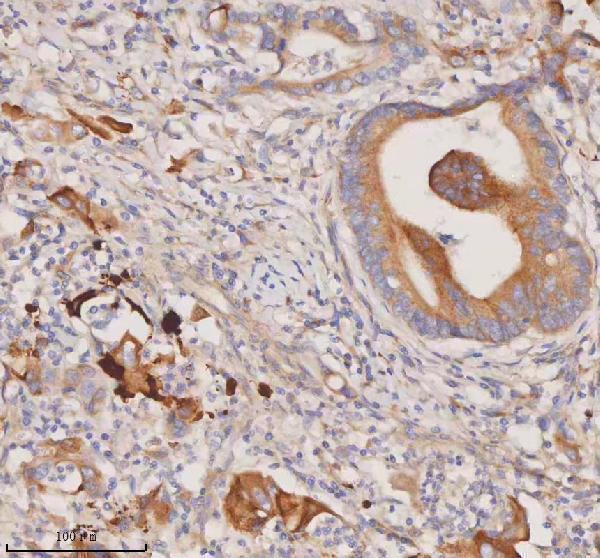 a00244 3 ddx58 primary antibodies ihc testing 7