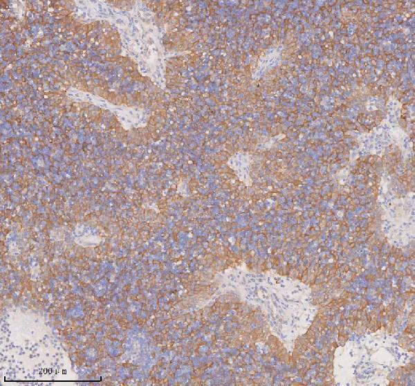 a00244 3 ddx58 primary antibodies ihc testing 8