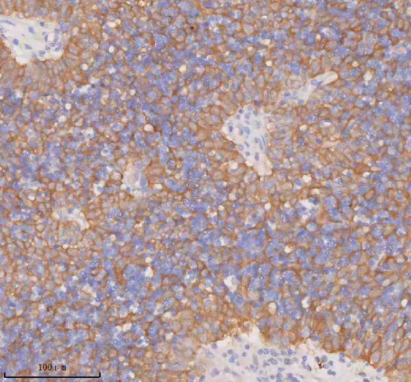 a00244 3 ddx58 primary antibodies ihc testing 9