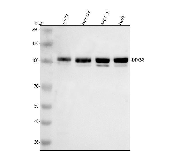 a00244 3 ddx58 primary antibodies wb testing 1