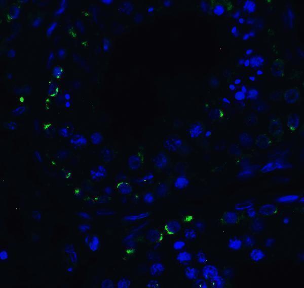 a00244 ddx58 primary antibodies if testing 4